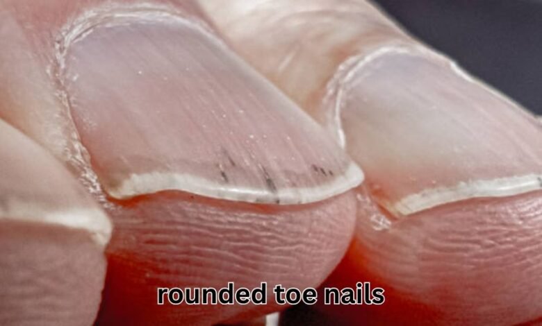 rounded toe nails